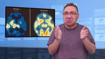  Mózg człowieka z depresją – jak wygląda?